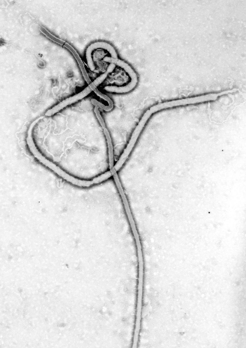 Electron micrograph of Ebola virus particles